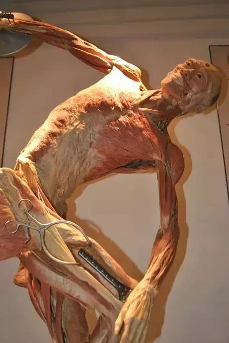在这幅标本中,由于扩张器很难得的可以看到髂胫束和股外侧肌的关系