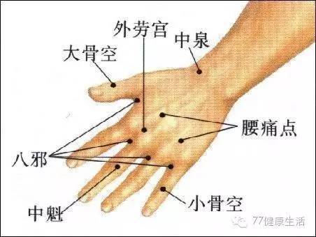 (2)手掌發麻,針刺後溪穴,朝勞宮穴方向透刺