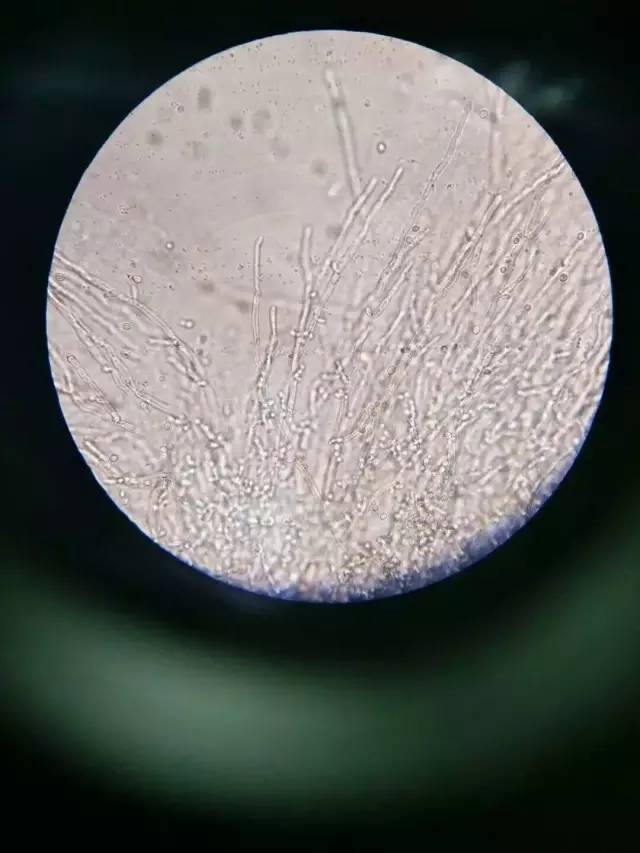 假丝酵母的芽细胞