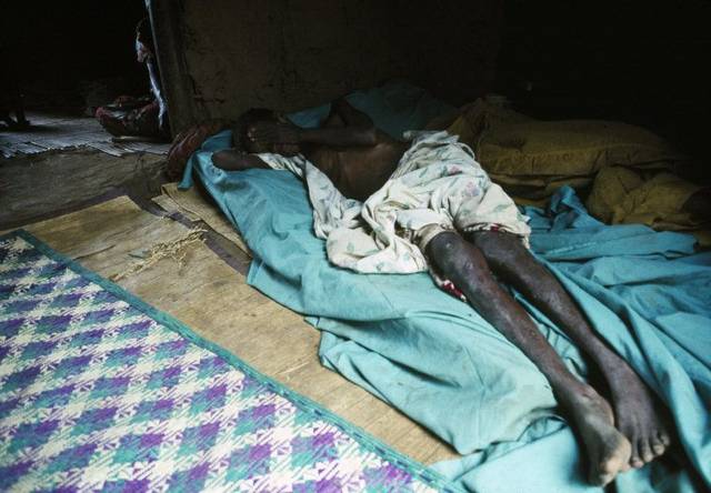 1987年乌干达的艾滋病患者,他们都死光了