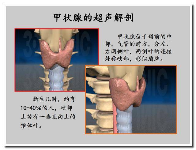 甲狀腺瘤是癌症嗎 甲狀腺良性腫瘤手術後能參加保險嗎