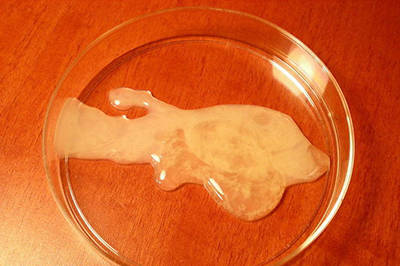 孕晚期果冻状分泌物图图片