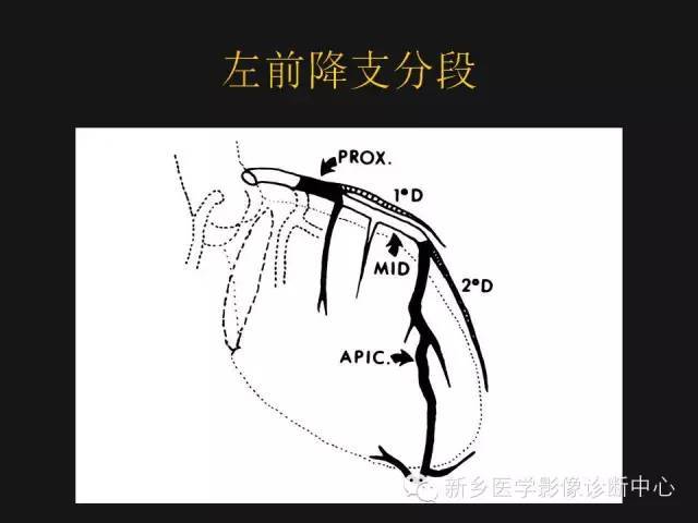 左回旋支分支解剖图片