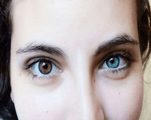 患有虹膜异色症才会两只眼睛呈现不一样的颜色,但这样近看实在是很美