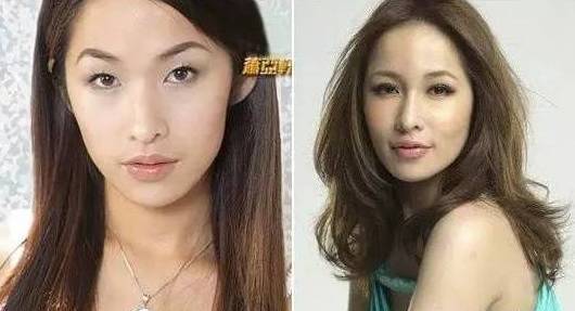 萧亚轩又变脸了她自己却打死不承认整容所以她变形的脸难道是因为没化