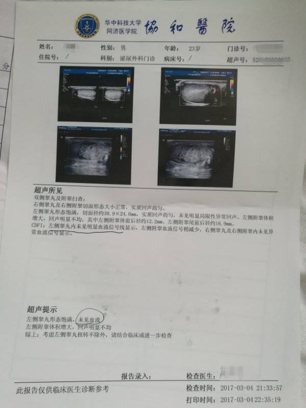 前来武汉协和医院西院泌尿外科就诊,急诊彩超显示,左侧睾丸已没有血供