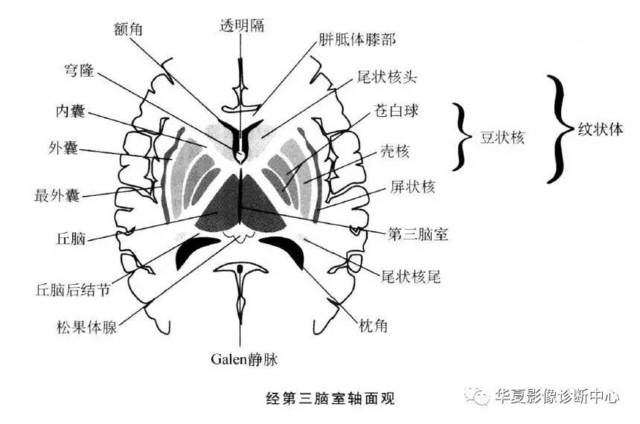 脑基底节区解剖图图片