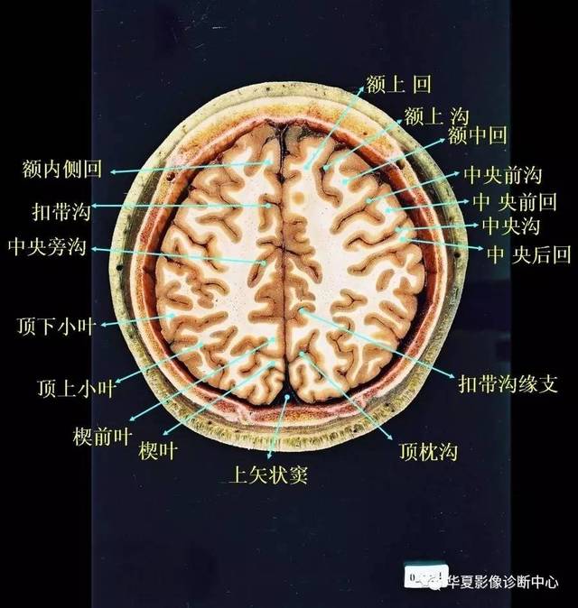 可与我们联系,我们将立即进行删除处理 三沟五三沟五叶mr叶分界枕沟