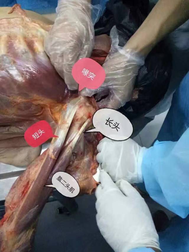 解剖手术 男子图片