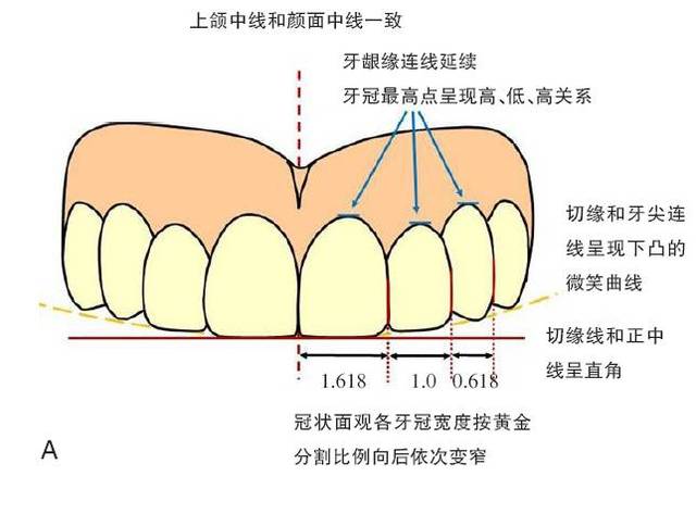 【口腔修复进修医师常见问题】如何确定前牙冠的长度和位置?
