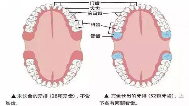 拔智齿全过程图片