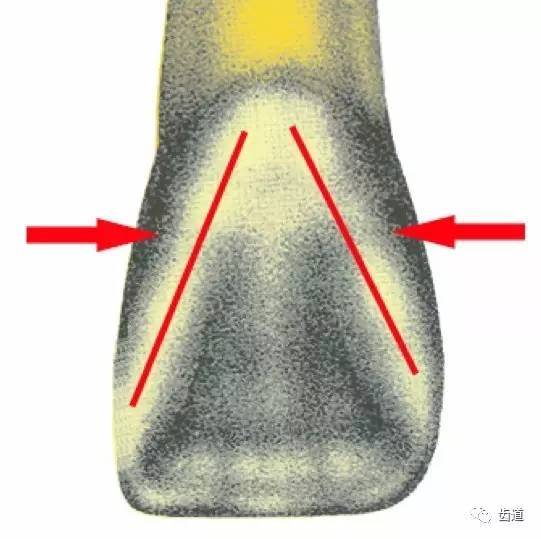 上颌中切牙素描画法图片
