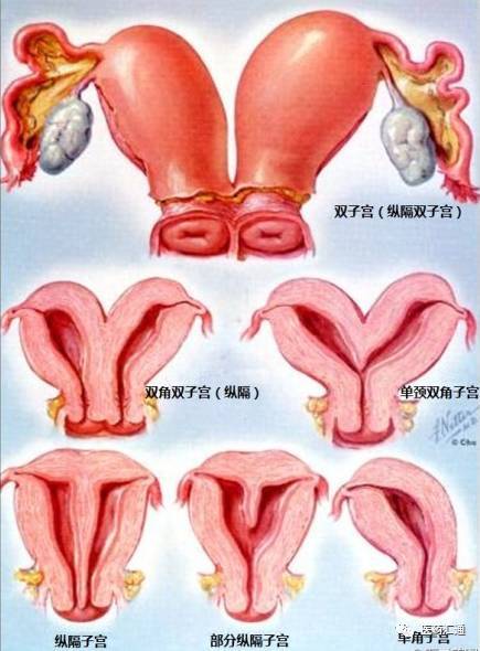 宫颈口不规则形状图片图片