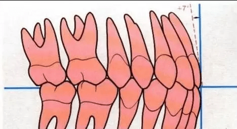 牙齿正常倾斜角度图图片