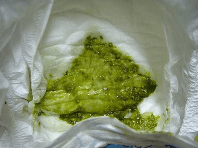 绿色粘液便图片