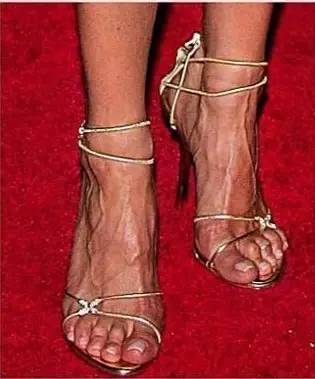 最迷恋高跟鞋的明星之一, 因为长期穿恨天高导致 脚趾变形严重, 她不