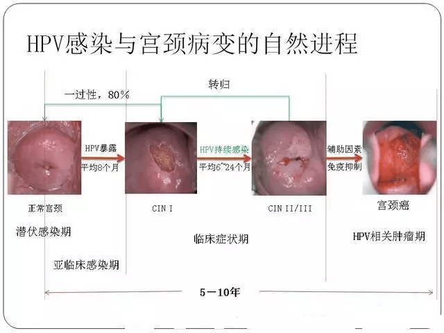 hpv病毒照片女性真人图片