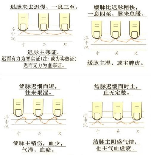 普通人都能学会的中医基础,看图学把脉吧