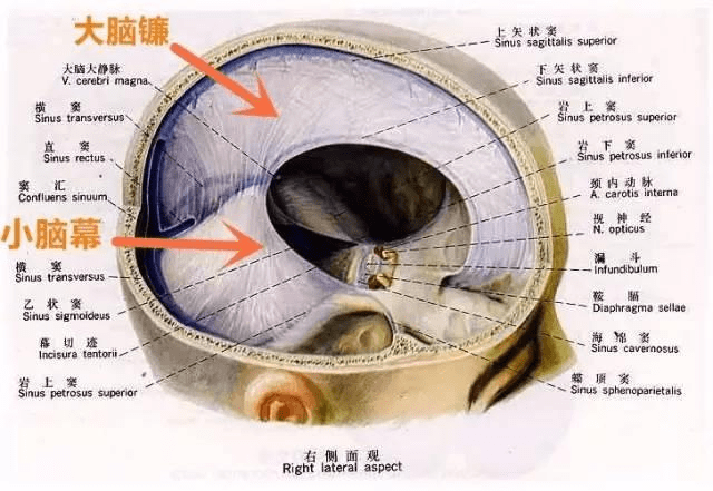 大脑镰解剖图图片