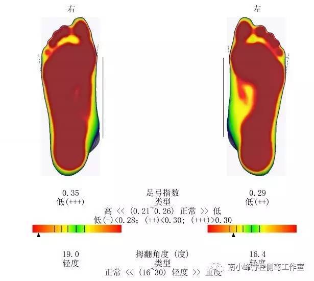 走路脚底受力图图片