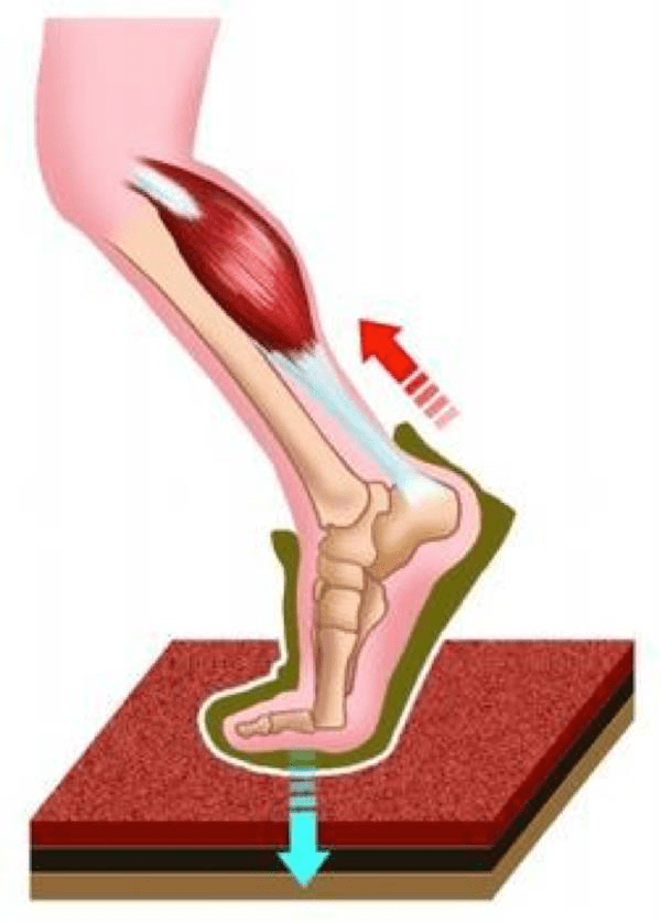 跟腱炎的產生及處理方法