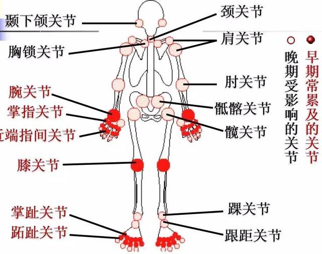 人体八大关节示意图图片