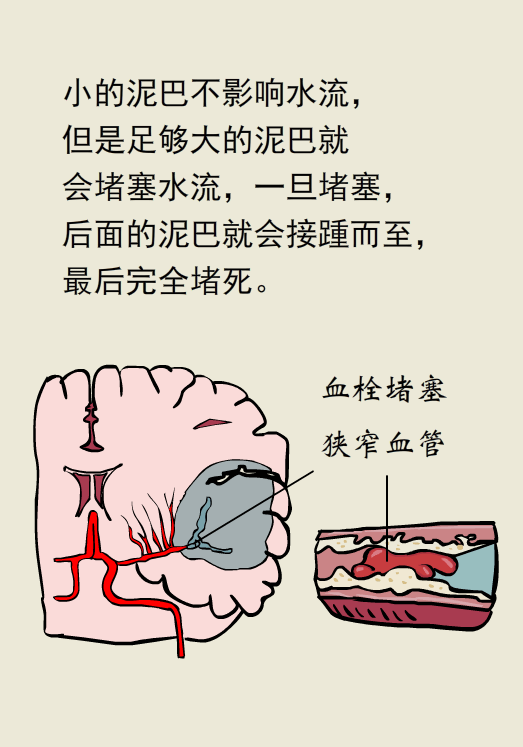 血栓卡通图片