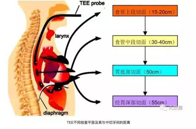 为便于掌握,多数学者倾向于将超声切面分为食管上段切面,食管中段切面