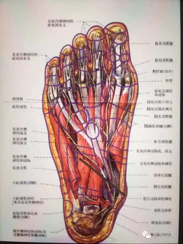 足底肌腱解剖图图片
