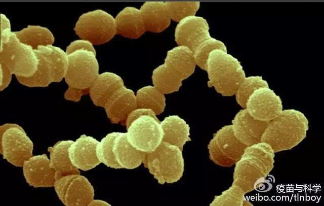 肺炎双球菌镜下图片图片