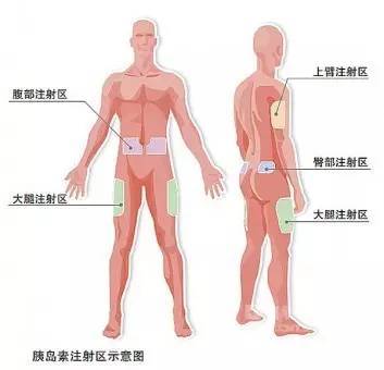 減少低血糖的出現,建議糖友們做到: (1)注射前仔細核對藥名和劑量