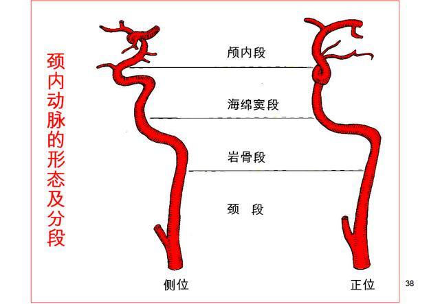 a 前循環(頸內動脈)供血不足型; b: 慢性後循環(椎-基底動脈)供血不足