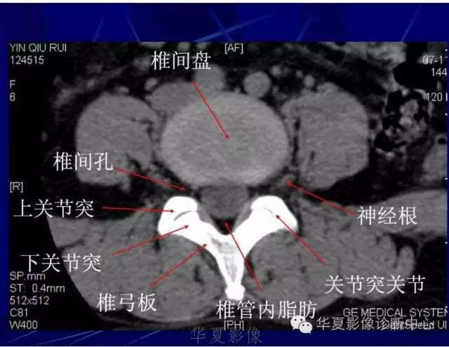 详细的腰椎解剖