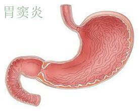 胃窦在左边还是右边图片