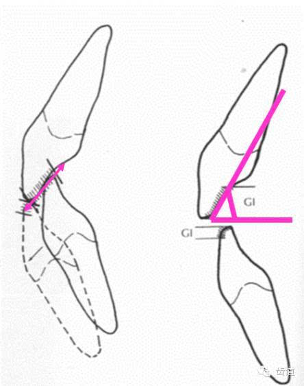 前牙有切道与切道斜度 切道:下前牙切缘前伸的轨道 切道斜度:切道与水