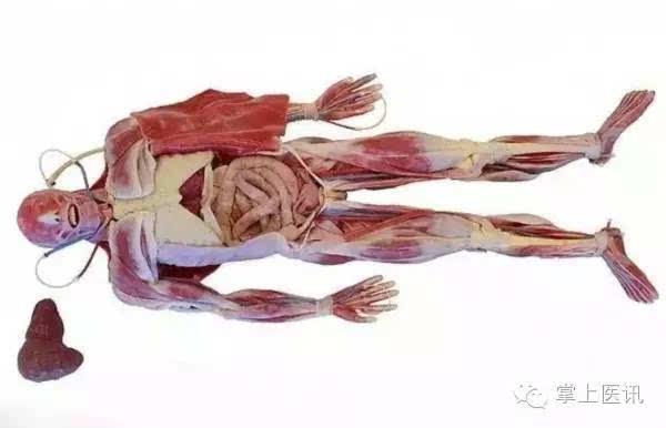 解剖男尸 取出图片