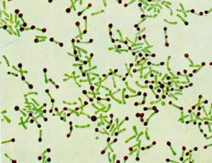 白喉棒状杆菌最美细菌图片