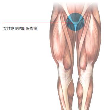 必看丨恥骨疼痛怎麼辦這幾招教你如何改善轉給她