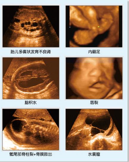 兔唇的四维图片大全图片