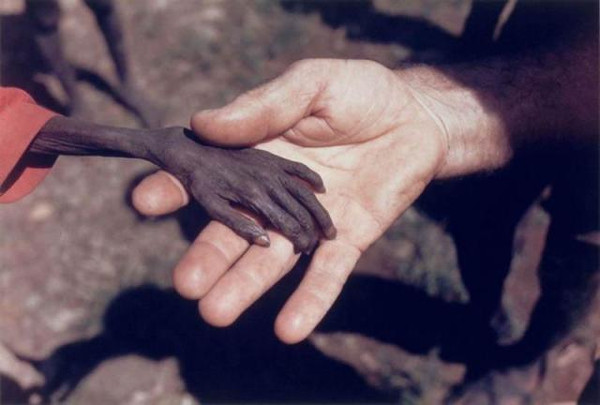 16】1980年,乌干达卡拉莫贾地区,一名传教士握着一个骨瘦如柴的小男孩