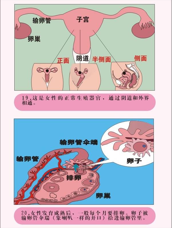 图解疾病   宫外孕