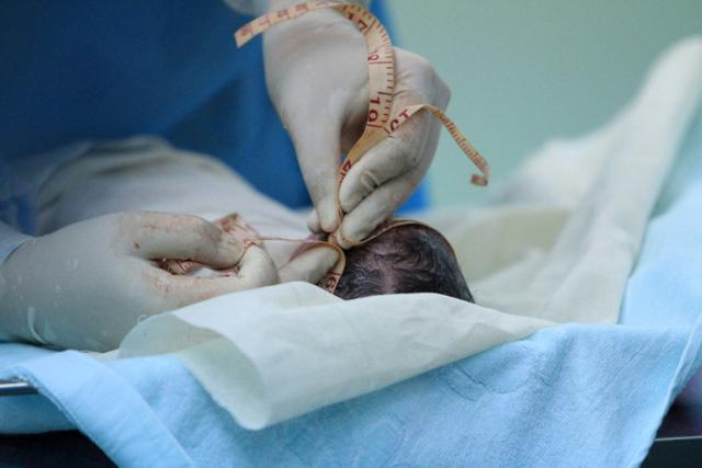 刚出生的女婴 下面图片