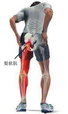 主要表现特征:疼痛是本病的主要表现,以臀部为主,并可向下肢放射,严重