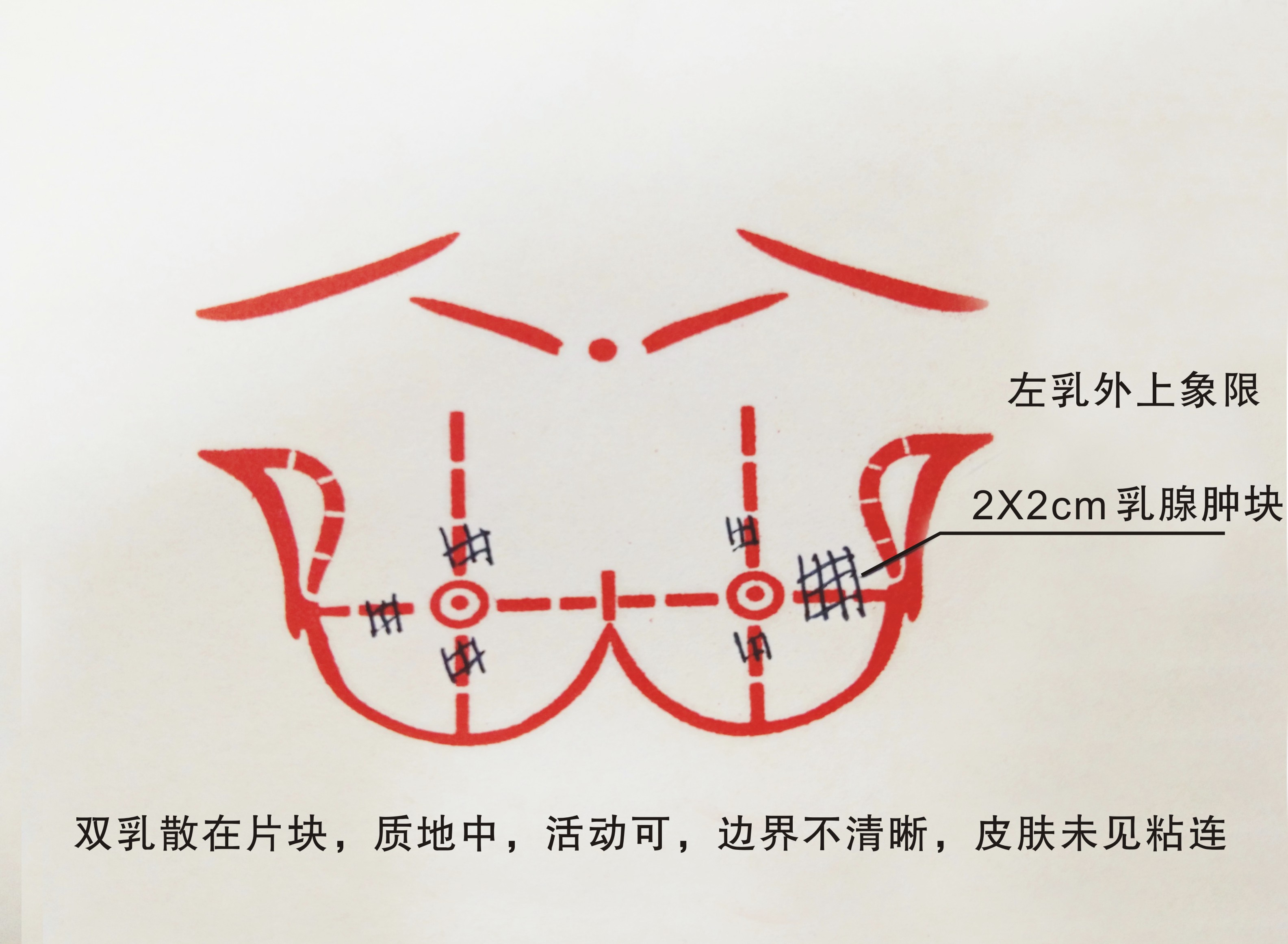 北京中医界有位诊治乳腺疾病的小金手