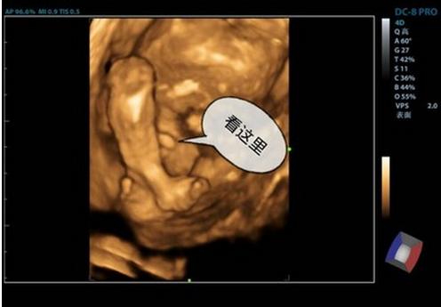 怀孕16周的宝宝图片图片