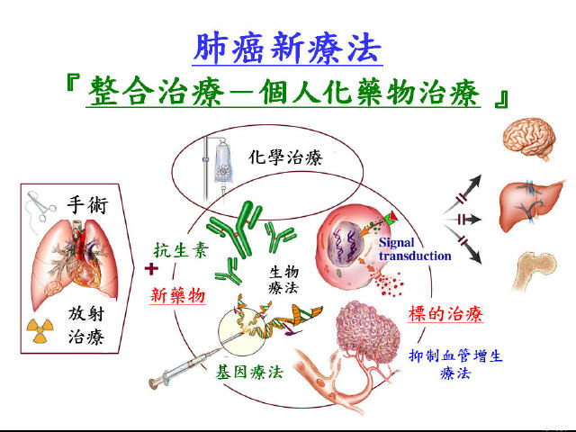 肺癌靶向治疗的应用