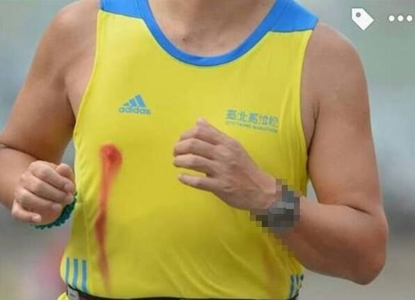 如何避免男性跑者磨伤乳头?