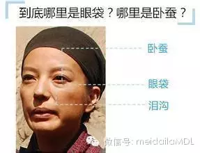 眼袋手术失败怎么办（眼袋手术失败了怎么办）-85模板网