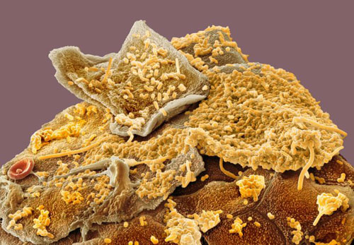 牙齿蛀虫显微镜图片