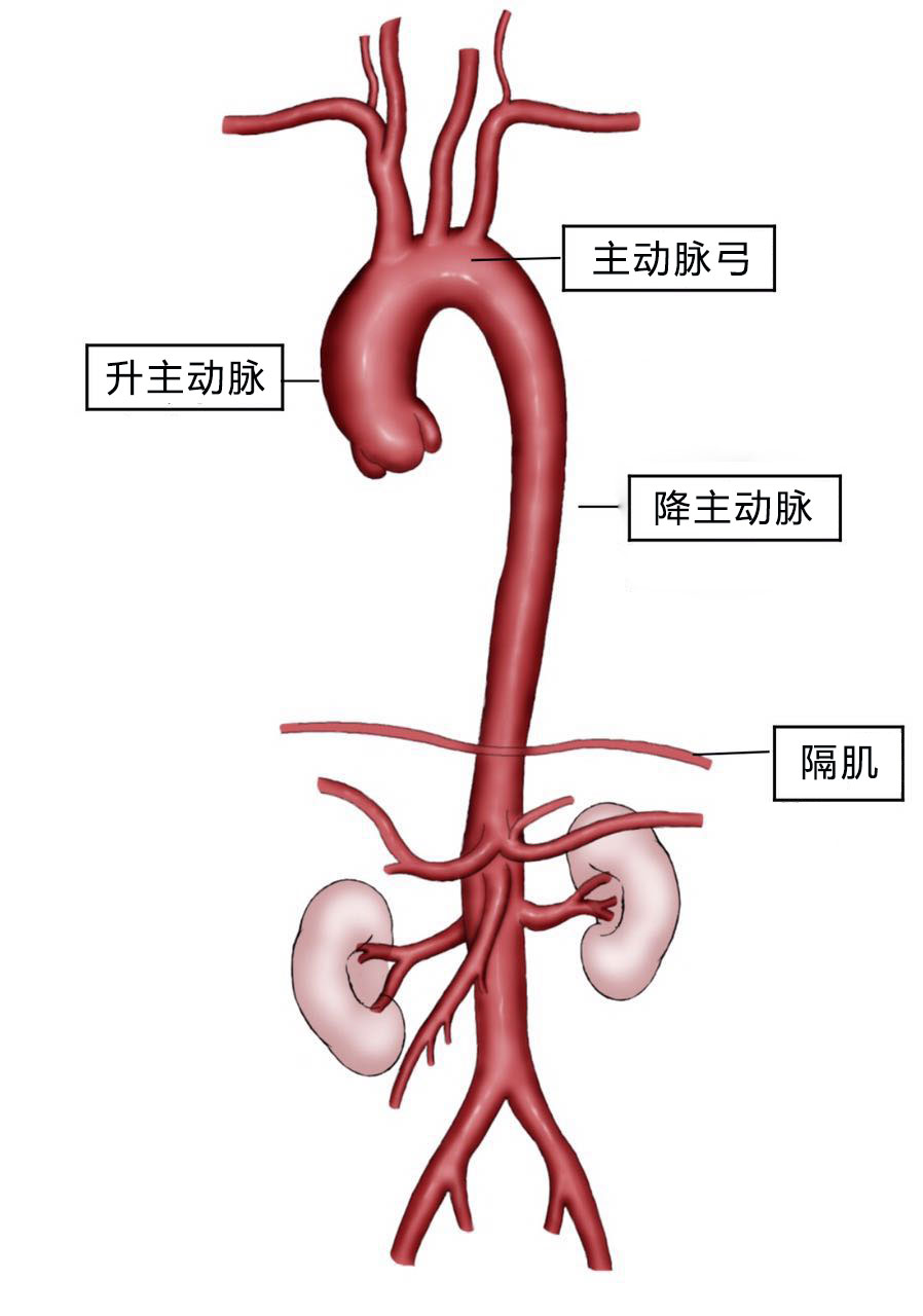 主动脉人造血管图片图片